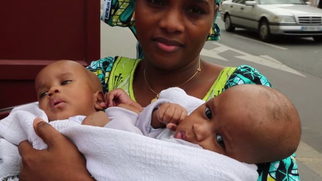 Des bébés siamois séparés avec succès à Paris