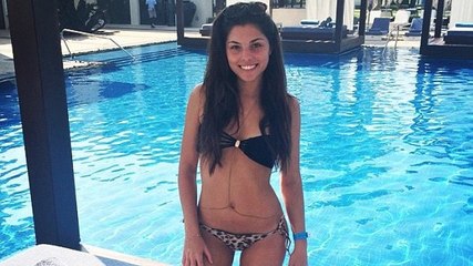 Ce mannequin est victime de violence conjugale après avoir posé dénudée