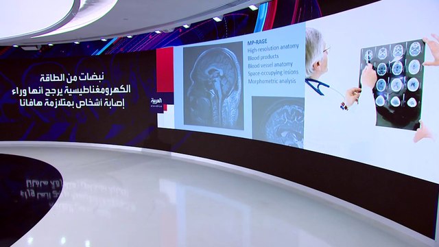 تقرير أميركي استخباراتي يكشف أسباب جديدة حول متلازمة هافانا