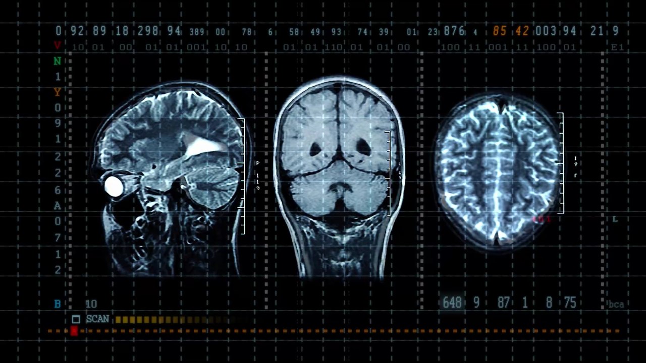 Kanada: Häufung an unerklärlichen Nervenerkrankungen