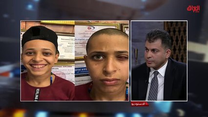 زراعة  العين البشرية وإمكانية ذلك مع اختصاصي طب وجراحة العيون