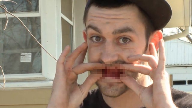 Il voulait seulement se faire arracher trois dents mais le dentiste en a décidé autrement