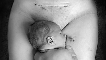 La photo d'une maman et de son bébé né par césarienne fait le tour du monde