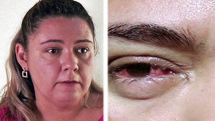 Cette femme avait une douleur aux yeux. Et elle s'est mise à pleurer des cristaux