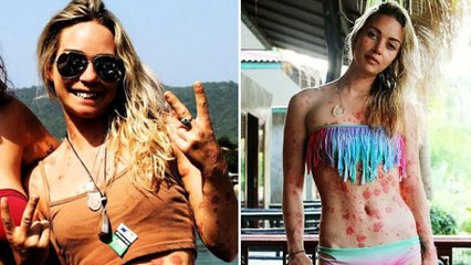 La réponse brillante d'une fille harcelée à cause de sa maladie de peau