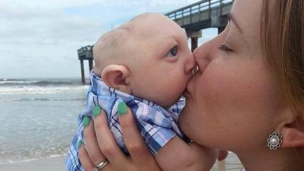 Atteint d'une malformation, ce bébé défie les médecins !