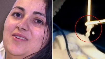 Les médecins font une découverte terrifiante dans le crâne d'une Américaine