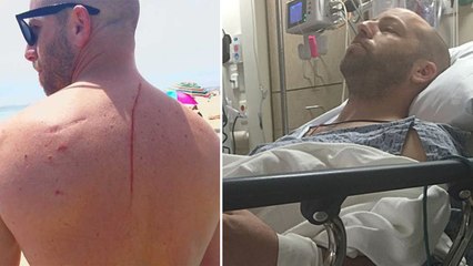 Il découvre qu'il est atteint d'un cancer après avoir été attaqué par un requin