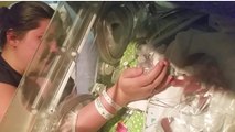 Un prématuré nait séparé de son jumeau toujours dans le ventre de sa mère...