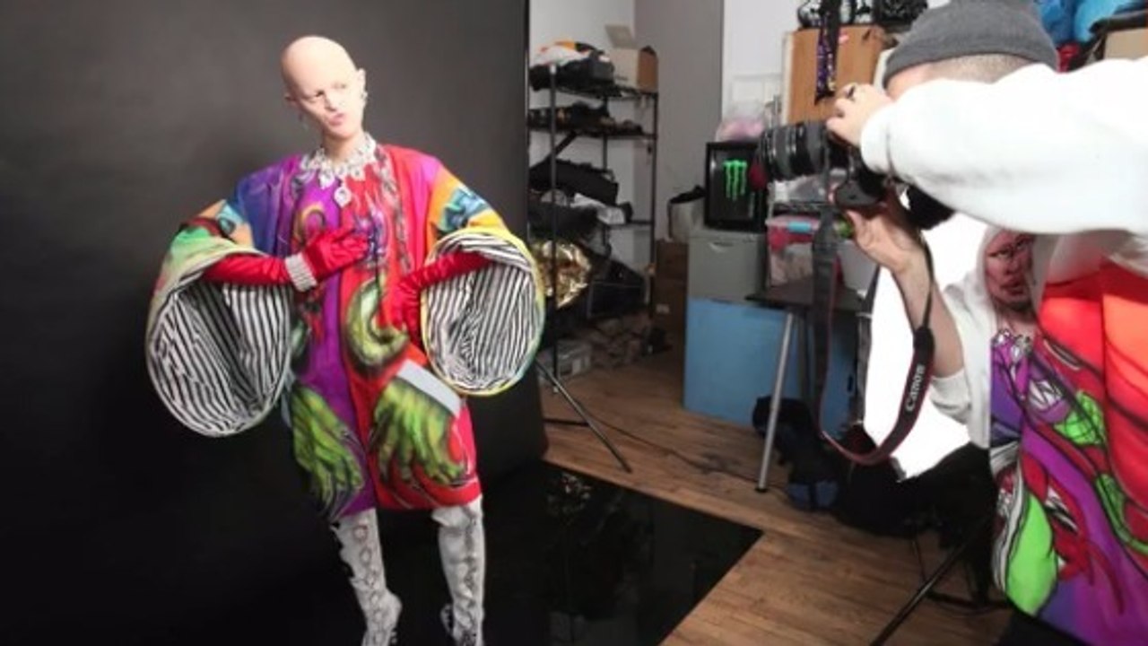 Ce mannequin atteint d'une rare maladie génétique crée la sensation sur internet