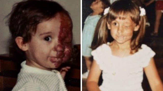 Défigurée depuis l'enfance à cause d'une tumeur au visage, elle prend une revanche sur la vie