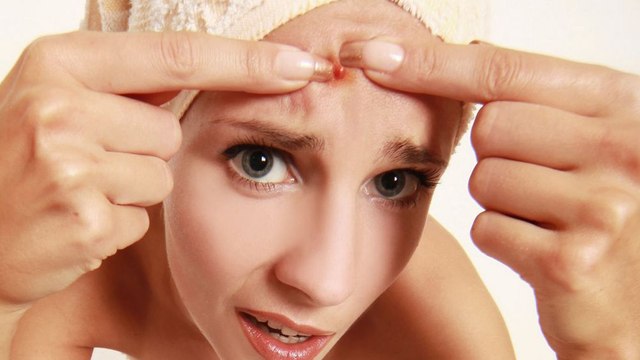 Quels aliments peuvent favoriser les boutons ? Voici les coupables