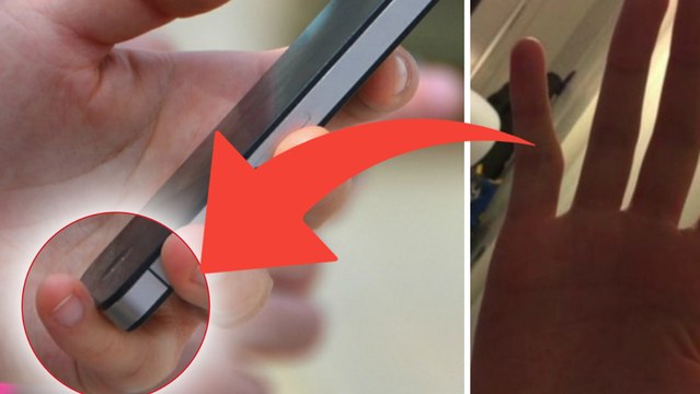 Smartphones : et si leur trop grande utilisation vous déformait les doigts ?