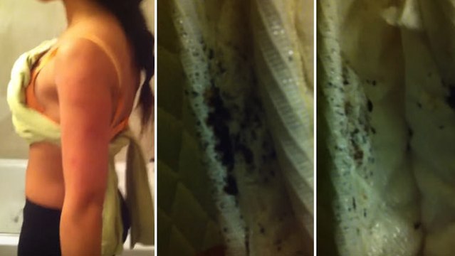 Il filme sa chambre d'hôtel à New York et découvre son lit infesté de punaises !