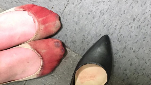 Cette serveuse crée la polémique en publiant la photo de ses pieds en sang au travail