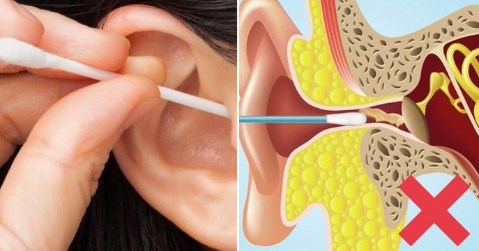 Comment faut-il faire pour bien se nettoyer les oreilles ?