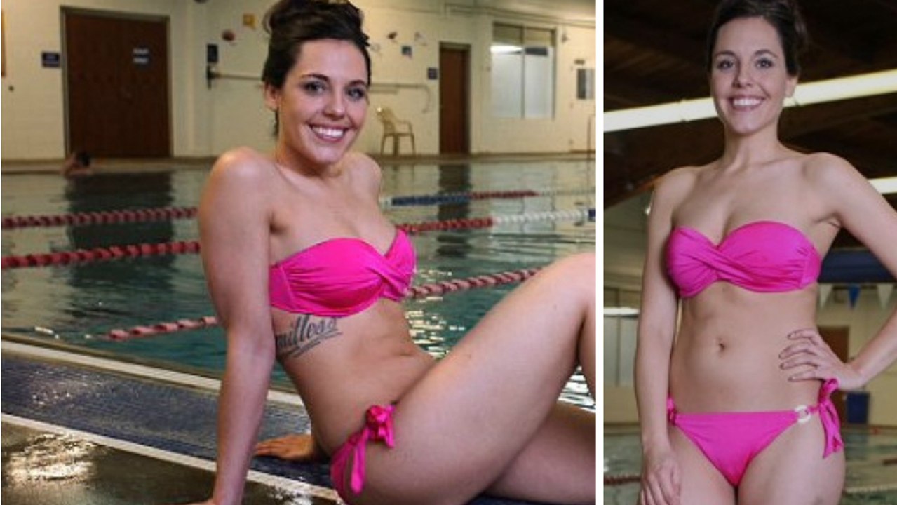 Traitée de " Bonhomme Michelin", elle ose enfin montrer sa jambe malade