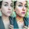 L'actrice Ciena Rae Nelson poste des photos de son psoriasis pour faire passer un message fort !