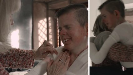 Âgé de 22 ans et atteint d'une rare maladie de peau, James Dunn mène un combat dans sa vie de tous les jours