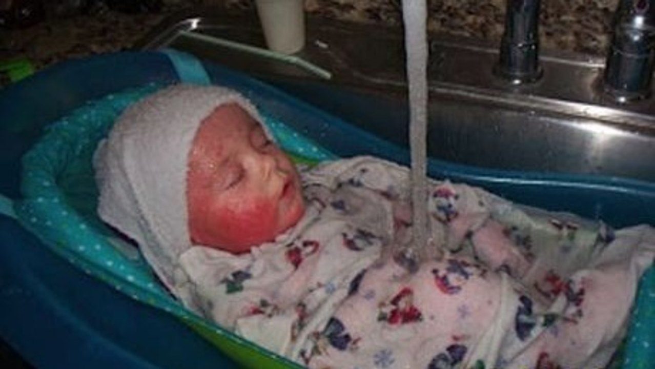 Une maman sauve son bébé d'une maladie de la peau en arrêtant ses médicaments