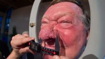 Championnat du monde du plus gros nez : le plus gros nez du monde mesure près de 66 millimètres de longueur