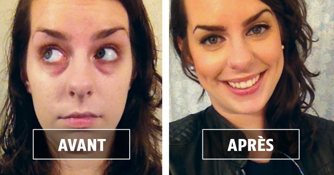 Cernes : 4 astuces de pro pour avoir le regard frais et reposé