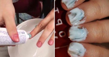 Découvrez la méthode magique pour blanchir vos ongles rapidement