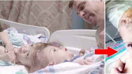 Ces bébés siamois ne pouvaient être indépendants l'un de l'autre... Les voici après l'opération !