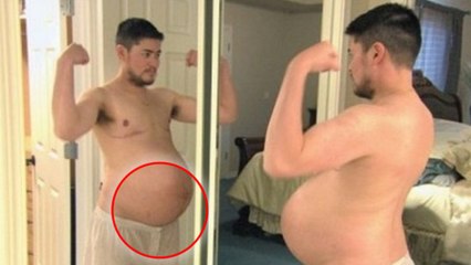 Secret Story 10 : Thomas Beatie se confie à propos de ses opérations et de sa prise d'hormones