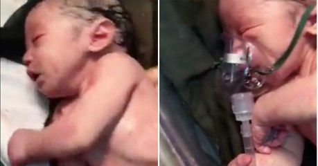 Grossesse : un médecin sauve la vie d'une petite fille "mort née"