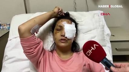 Hatay'da tüyler ürperten olay! 'Ağabey' demeyen yengesini 37 yerinden bıçaklayıp kör etti