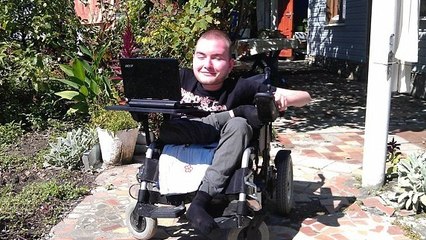 Médecine : une greffe de tête sur un corps en prévision