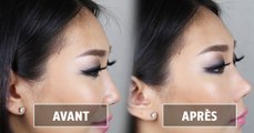 Nose Lifter : le gadget venu d'asie qui modifie la forme du nez sans chirurgie esthétique