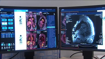 Pacientes con cáncer ven reducidas sus posibilidades de curarse con la llegada del Covid