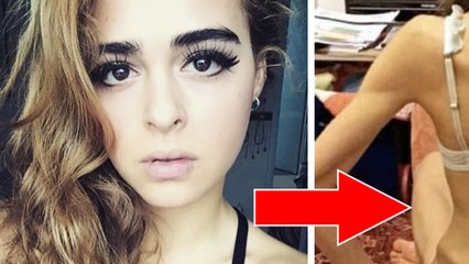 Margherita Barbieri : à 13 ans, elle était la plus jolie fille de la classe... mais elle révèle l’affreuse vérité