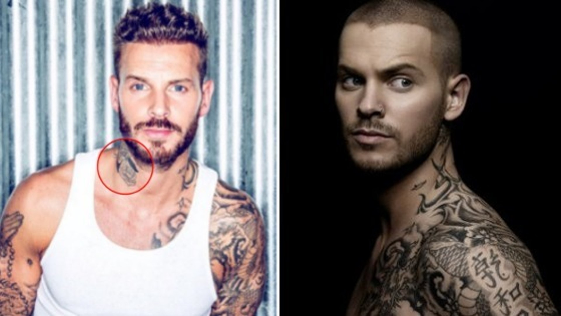 Matt Pokora Détatouage Avant Après