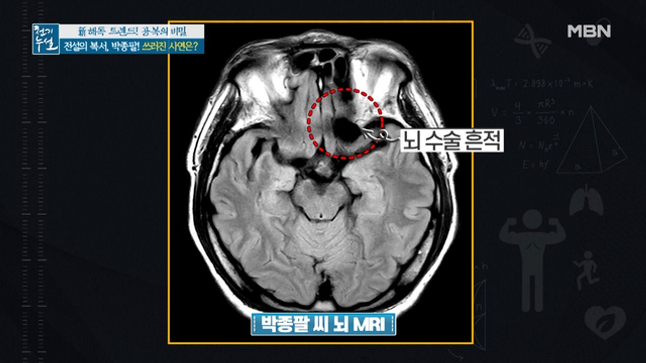 전설의 복서, 박종팔! 죽을 고비를 넘긴 사연은?