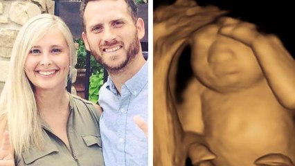 Keri Young : elle décide d'accoucher de son bébé condamné pour une très belle raison