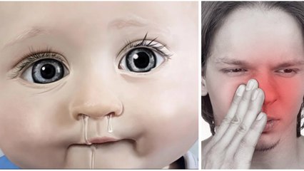 Grâce à cette astuce, vous n'aurez plus jamais le nez bouché !