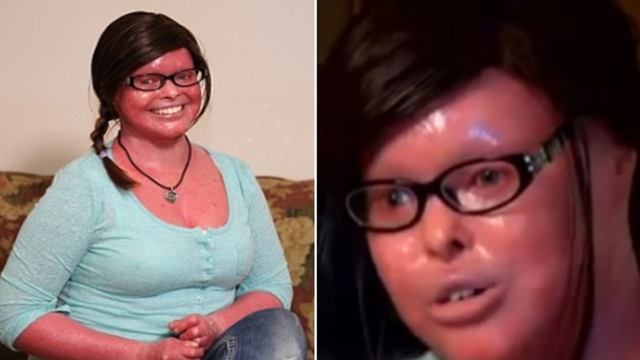 Stephanie Turner est née avec une maladie extrêmement rare mais parvient à donner naissance à deux enfants totalement normaux