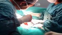 Siirt'te kadın hastanın midesinden 1,5 kilogram taşlaşmış saç yumağı çıktı