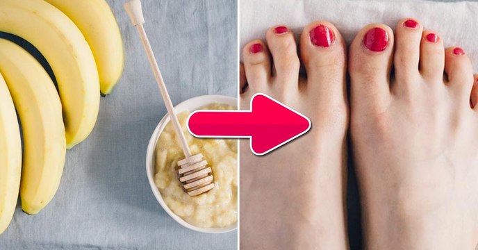 Pieds secs : l'astuce de la peau de banane pour hydrater ses pieds