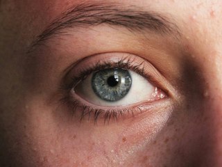 Eczéma visage : causes et traitements naturels