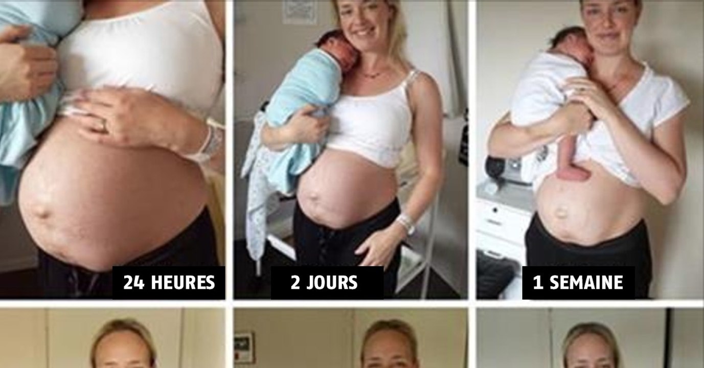 Elle montre la vraie évolution du ventre d'une maman après son accouchement. Des images sans filtre!