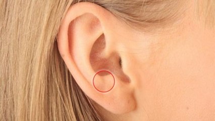 Le signe de Frank : saviez qu'un détail de vos oreilles pouvait vous alerter en cas de risque d'AVC ?