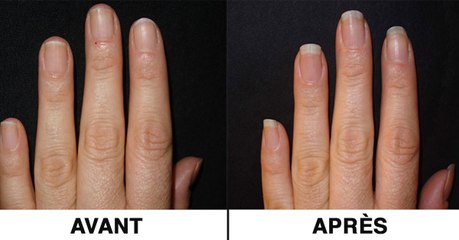 Manucure : le bain miracle pour faire pousser ses ongles plus vite