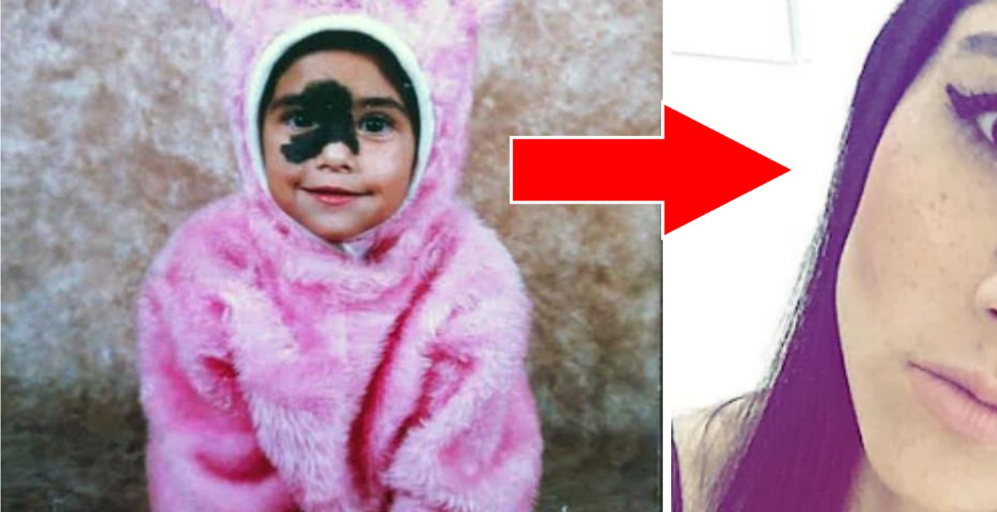 Mariana Mendes: cette jeune fille fait de sa tâche de naissance sur le visage une force