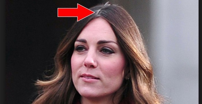 Attention à ne pas sous-estimer ses premiers cheveux blancs, cela peut vouloir dire quelque chose sur votre santé