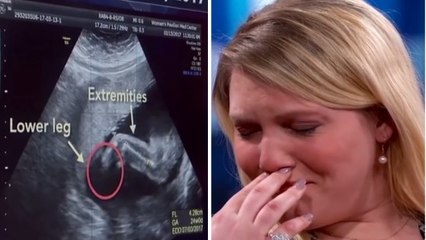 Grossesse : ce médecin découvre une anomalie sur l'échographie de cette jeune femme