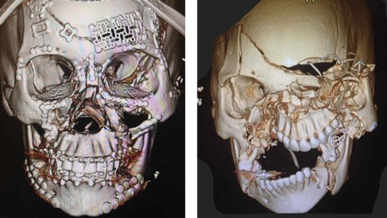 Ce scanner de crâne prouve à quel point il est important d'attacher sa ceinture de sécurité en voiture